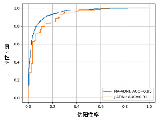 富士膠片AI技術(shù)可預(yù)測(cè)認(rèn)知癥是否會(huì)進(jìn)展為阿爾茨海默病