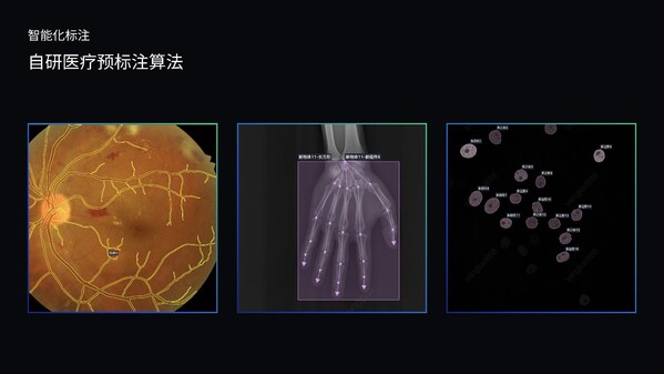 澳鵬MediGo平臺(tái)集成醫(yī)療專(zhuān)用NER模型、問(wèn)答對(duì)自動(dòng)生成系統(tǒng)和自研預(yù)標(biāo)注算法